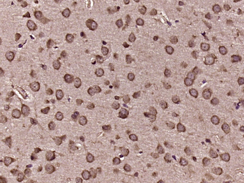 MYO15A Rabbit Polyclonal Antibody