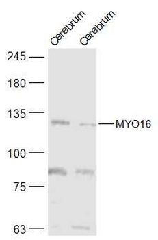MYO16 Rabbit Polyclonal Antibody