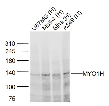 MYO1H Rabbit Polyclonal Antibody