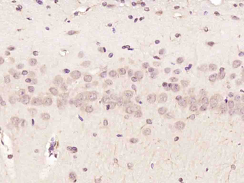 NUP88 Rabbit Polyclonal Antibody
