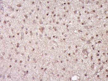 NACAD Rabbit Polyclonal Antibody