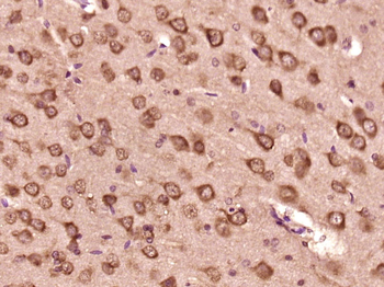 NACAD Rabbit Polyclonal Antibody