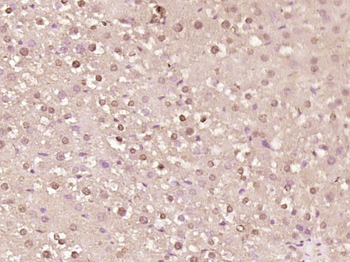 Nance-Horan Syndrome Protein Rabbit Polyclonal Antibody