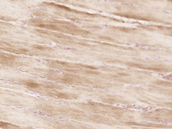 NBAS Rabbit Polyclonal Antibody