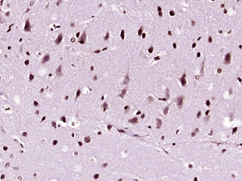 NDST4 Rabbit Polyclonal Antibody