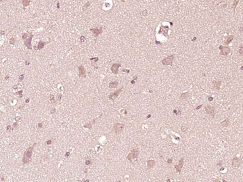 NDUFB1 Rabbit Polyclonal Antibody