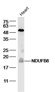 NDUFB8 Rabbit Polyclonal Antibody