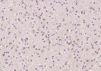 NR1D2 Rabbit Polyclonal Antibody