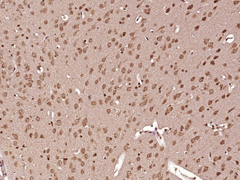 Nesprin 3 Rabbit Polyclonal Antibody