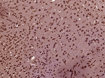 Nesprin 3 antibody
