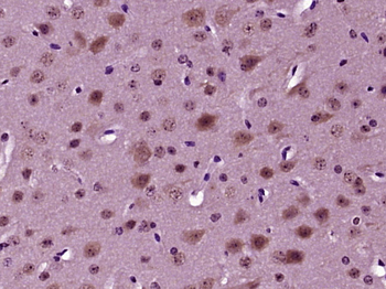 Phospho-NEUROD1 (Ser274) Rabbit Polyclonal Antibody