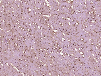 NOTCH4 Rabbit Polyclonal Antibody