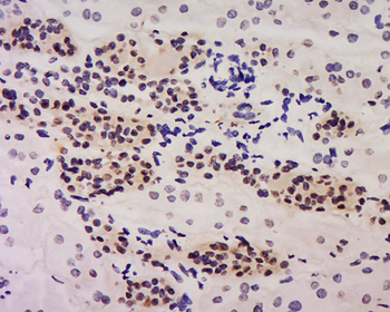 NHP2 Rabbit Polyclonal Antibody