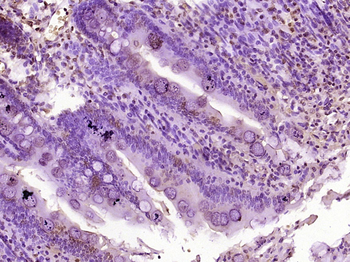 NMES1 Rabbit Polyclonal Antibody