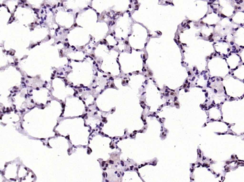 NOL11 Rabbit Polyclonal Antibody