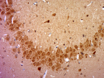 NPAS2 Rabbit Polyclonal Antibody