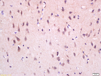 NGFB Rabbit Polyclonal Antibody