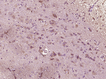 NPL4 Rabbit Polyclonal Antibody