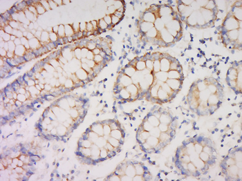NRAP Rabbit Polyclonal Antibody