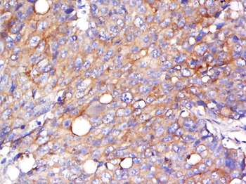 NRBP2 Rabbit Polyclonal Antibody