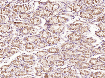PIWIL1 Rabbit Polyclonal Antibody