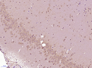 Site 2 protease Rabbit Polyclonal Antibody