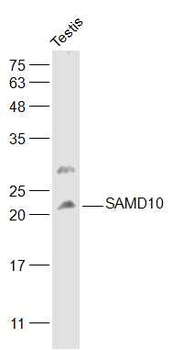 SAMD10 Rabbit Polyclonal Antibody