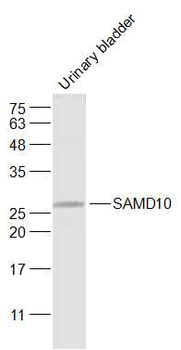 SAMD10 Rabbit Polyclonal Antibody