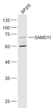SAMD11 Rabbit Polyclonal Antibody