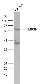 TM9SF1 Rabbit Polyclonal Antibody