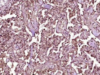 TBX5 Rabbit Polyclonal Antibody