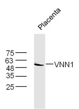 VNN1 Rabbit Polyclonal Antibody