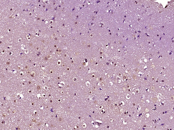 ZFP28 Rabbit Polyclonal Antibody