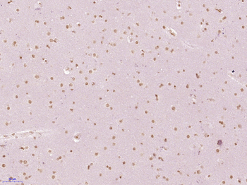 ZFP30 Rabbit Polyclonal Antibody