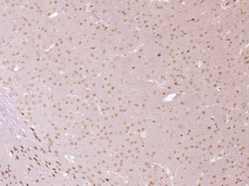 ZFP38 Rabbit Polyclonal Antibody