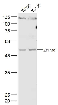 ZFP38 Rabbit Polyclonal Antibody