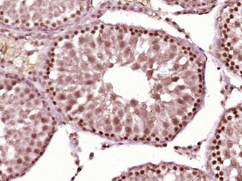 ZFP62 Rabbit Polyclonal Antibody