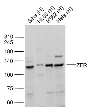 ZFR Rabbit Polyclonal Antibody