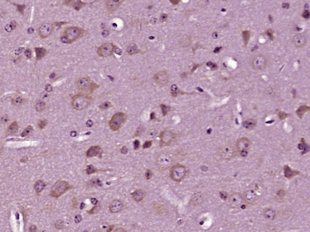 ZFY19 Rabbit Polyclonal Antibody