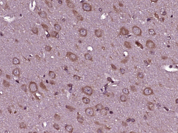 ZFY19 Rabbit Polyclonal Antibody