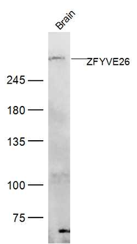 ZFYVE26 Rabbit Polyclonal Antibody