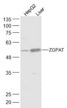 ZGPAT Rabbit Polyclonal Antibody