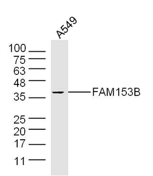 FAM153B Rabbit Polyclonal Antibody
