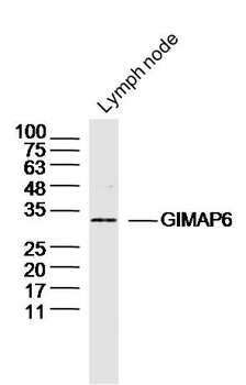 GIMAP6 Rabbit Polyclonal Antibody