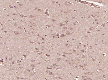 GIMAP2 Rabbit Polyclonal Antibody