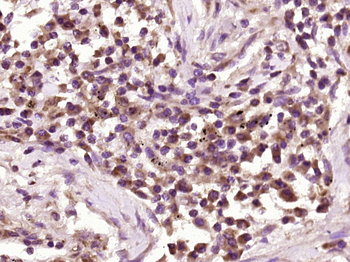 GIMAP2 Rabbit Polyclonal Antibody