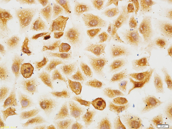GIMAP2 Rabbit Polyclonal Antibody