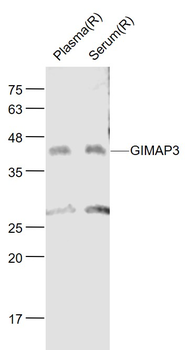 GIMAP3 Rabbit Polyclonal Antibody