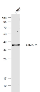 GIMAP5 Rabbit Polyclonal Antibody