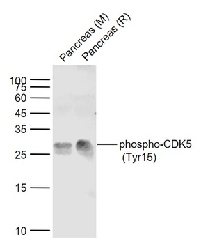CDK5 (phospho-Tyr15) antibody